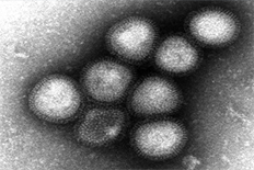 AI(H7N9) 바이러스 전자현미경 사진