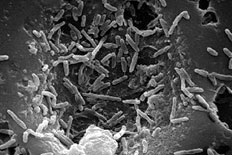 우결핵균(M. bovis) 전자현미경 사진